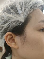 -长沙雅美医疗美容医院