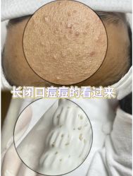 -美愈美肤MEIYU SKIN