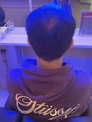 点击看大图 -碧莲盛·脱发养发中心
