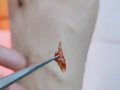 -新甲连锁灰指甲·甲沟炎·鸡眼(黑龙江路店)