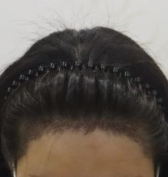 -熙朵美学植发·连锁品牌