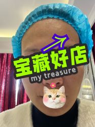 体验前-武汉颜范薇美医疗美容门诊部