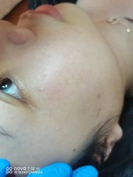-清疣美疣·痣·斑净肤中心