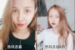 -SKINIST丽铂医疗美容
