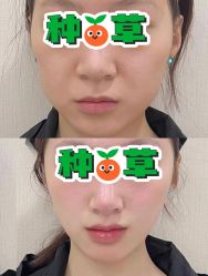 -丽都整形美容医院·全国连锁旗舰店