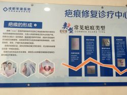 -成都军建医院·疤痕诊疗中心