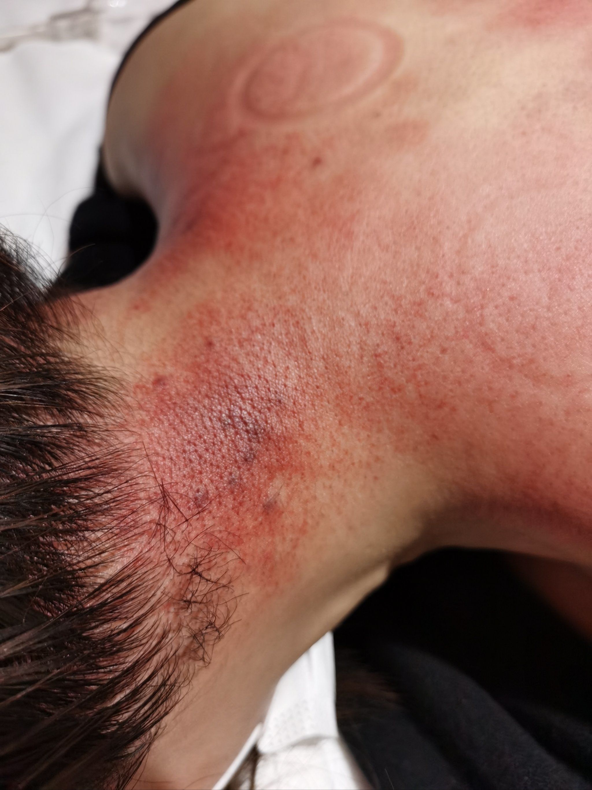 颈椎受寒脖子有点疼 今天赶快约做了身体
