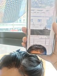 -碧莲盛·不剃发植发