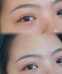 点击看大图 -杨益美学·野生眉半永久纹眉发际线