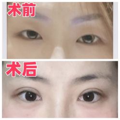 -素美医疗美容·西南眼鼻整形·修复基地