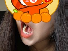 -美酷口腔牙齿矫正(江桥万达店)