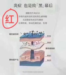 -MLP美丽派·问题肌疗愈中心