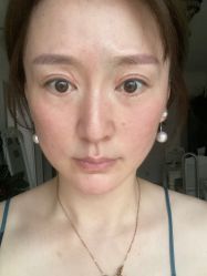 体验后-北京丽星翼美医疗美容