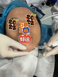 体验前-美瑞莎创美医疗美容