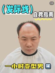 -唐风采假发补发定制