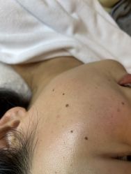-清疣美疣·痣·斑净肤中心