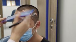 -大麦微针植发全国连锁