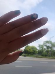 点击看大图 -初樱科技美学问题肌修复中心