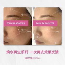 -苗方清颜痘肌研究所