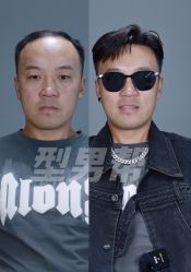 -型男帮男士假发补发·佩戴式发型