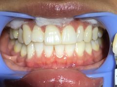 -齐玉齿科JADENTAL