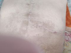 -中国人民解放军总医院(301医院)