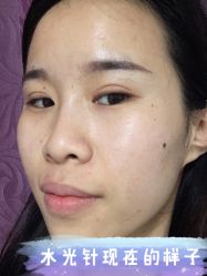 -新美荟医美·专注面部美学抗衰