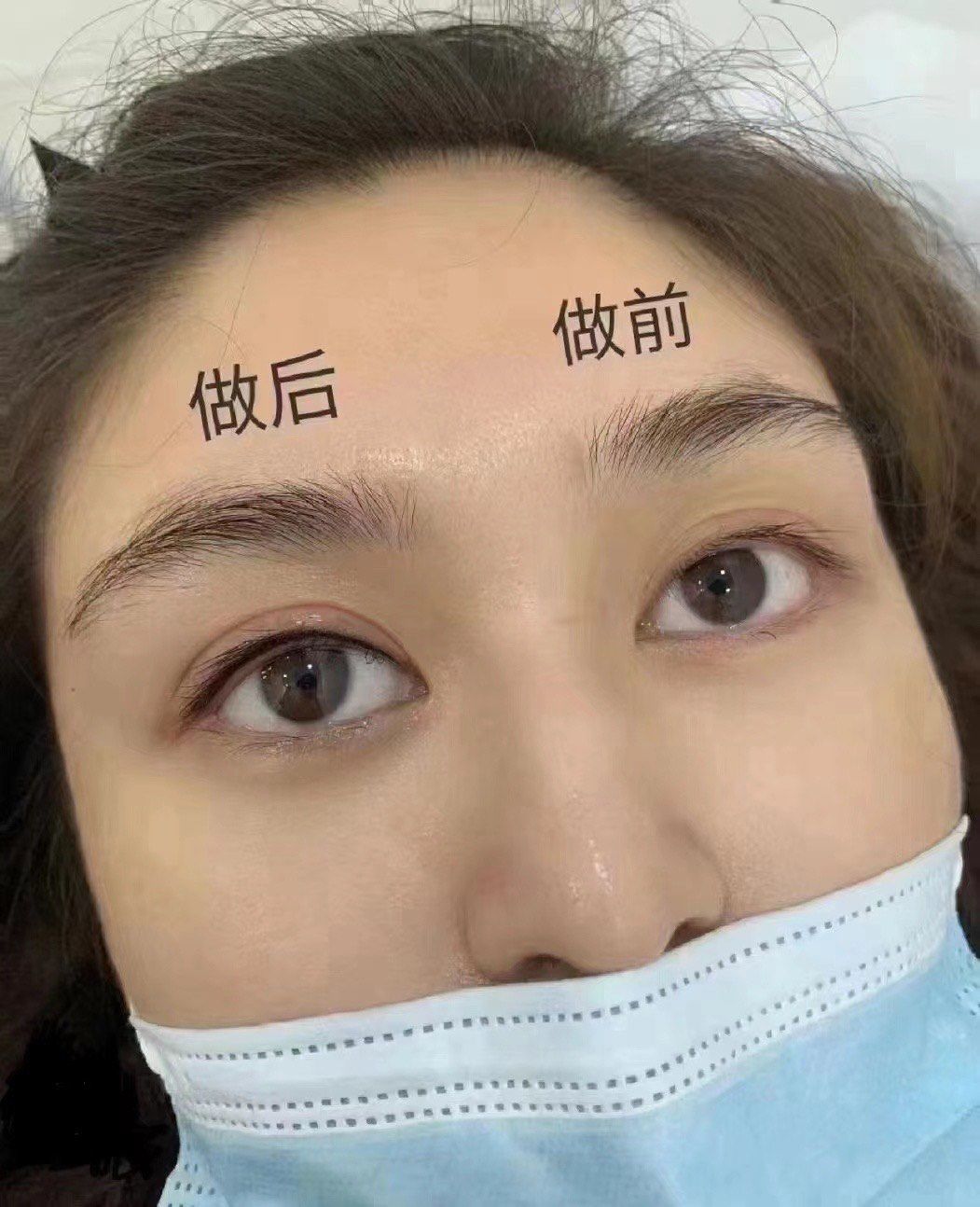 美瞳线做完一只的对比