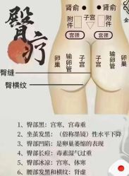 -克丽缇娜