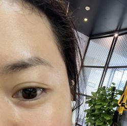 体验后-重庆联合丽格第五医疗美容医院