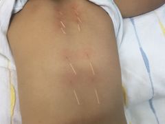 -中国中医科学院针灸医院