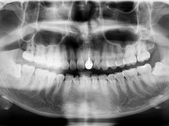 -深圳市人民医院(留医部)