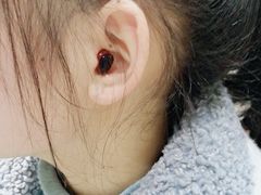 -自然之声助听器·呼吸机(贵定店)
