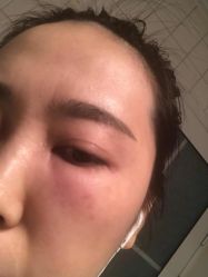-新美荟医美·专注面部美学抗衰