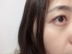 点击看大图 -初樱科技美学问题肌修复中心