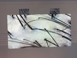 -雍禾植发全国连锁