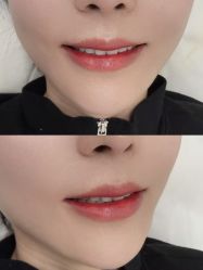 点击看大图 -西施无菌半永久纹绣眉眼影唇轻增发纹发际线