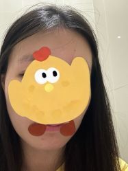 体验前-斐研美医疗美容·眼周抗衰中心