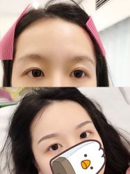 -MIVI半永久纹眉纹绣