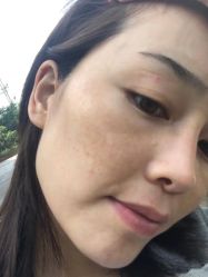 体验后-上海漾颜医疗美容