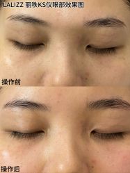 点击看大图 -丽锦汇LA LIZZ丽秩·科技美肤