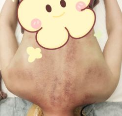 -Lily纤美·科技减脂中心
