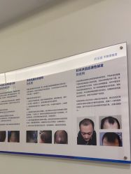 -碧莲盛·不剃发植发