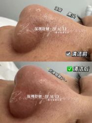 点击看大图 -DMK酶疗中心·BeautyYoung舒妍科技美肤