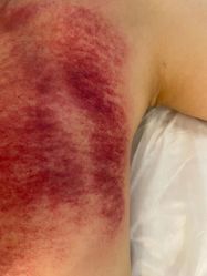 -简悦美塑·徒手点穴减肥