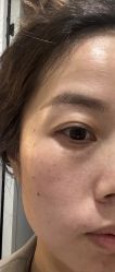 -agge蛋白医美
