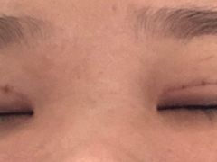 -东南大学附属中大医院(本部)