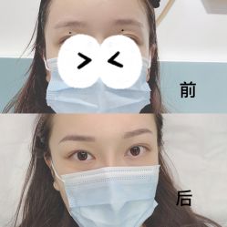 -久匠半永久纹眉