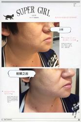 光SPA小V脸-光SPA科技美肤