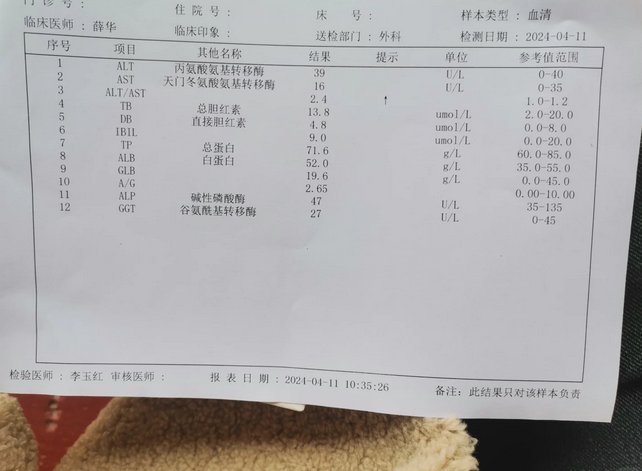 乙肝阴性图片